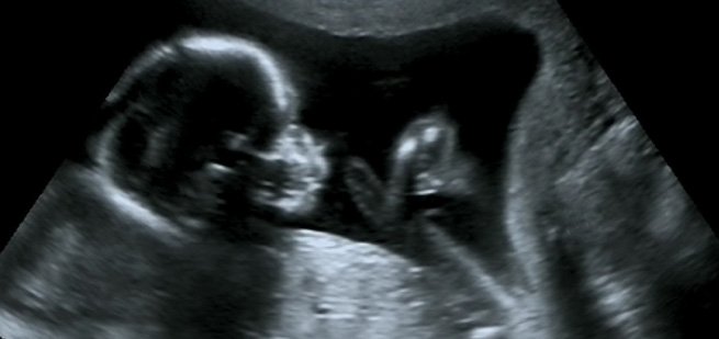 Trying To Conceive