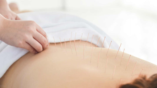 Acupuncture and Male Fertility: Does it Help?