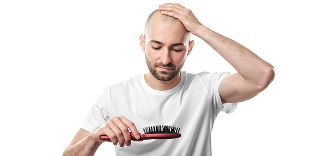 Male thinning hair Sperm Loss Fertility Connected to Hair Semen Analysis