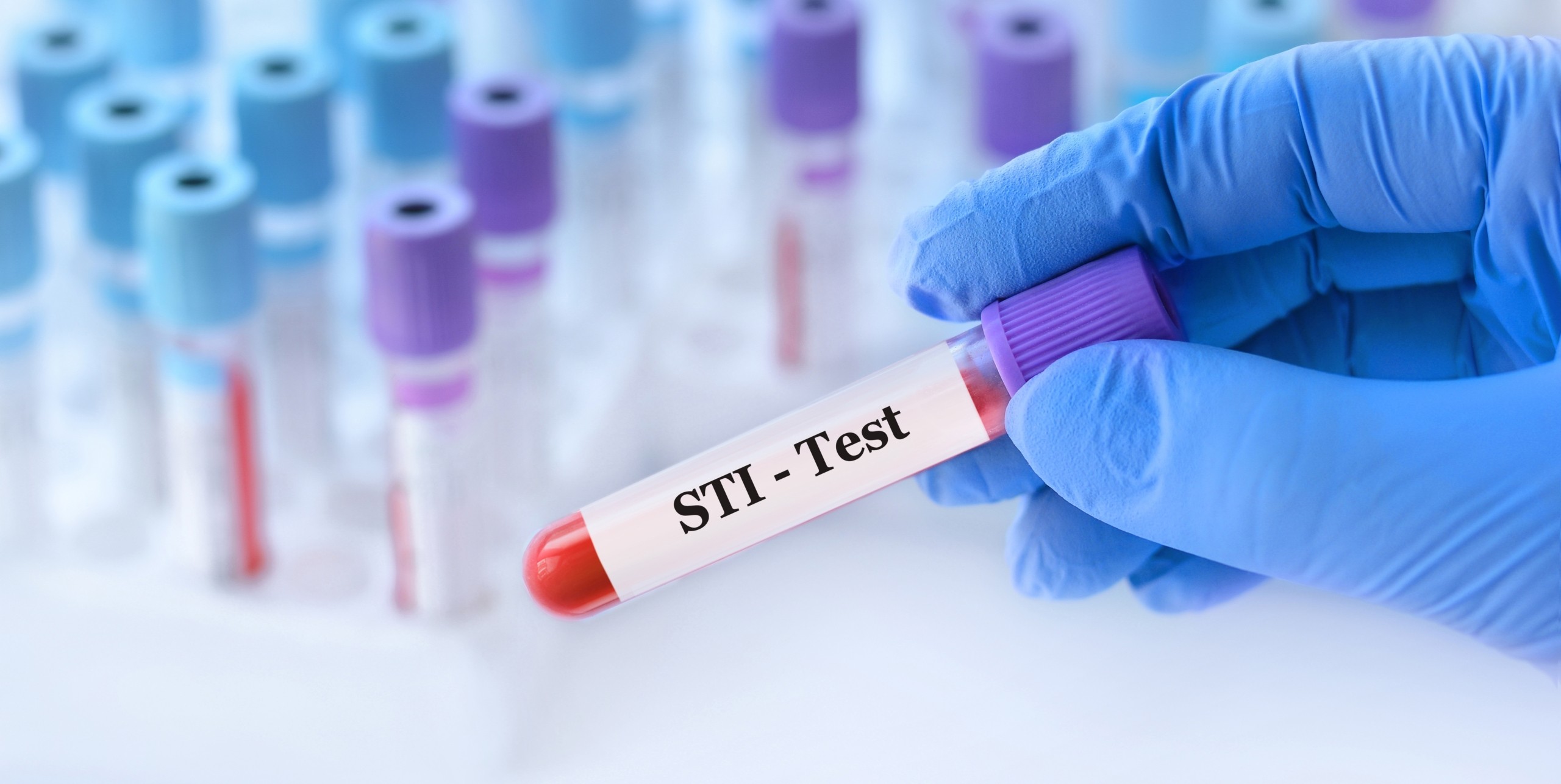 STIs and Male Fertility: What Men Need to Know